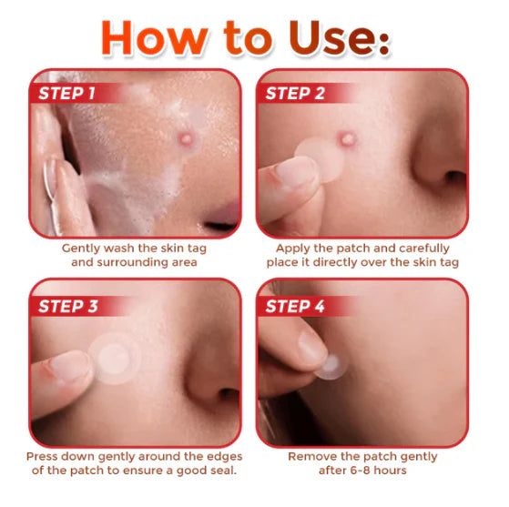 Slimoly™ MicroNeedle Botanic Skin Tag Removal Patch