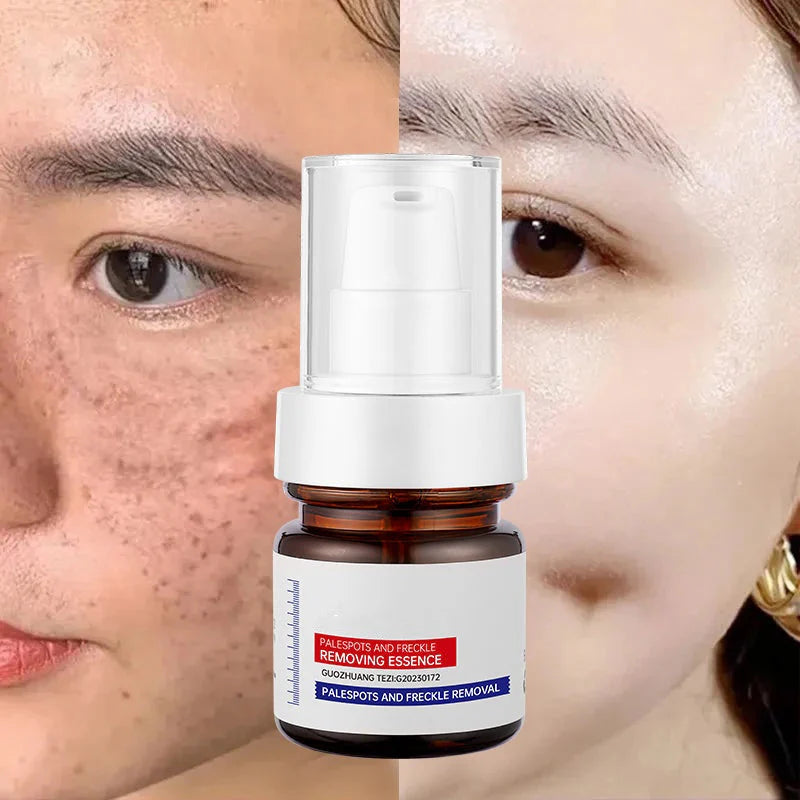 LOVILDS™  WHITENING ANDFRECKLE REMOVING ESSENCE