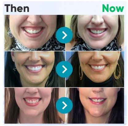 SmileFitPro™bee venom treatment powder for oral use