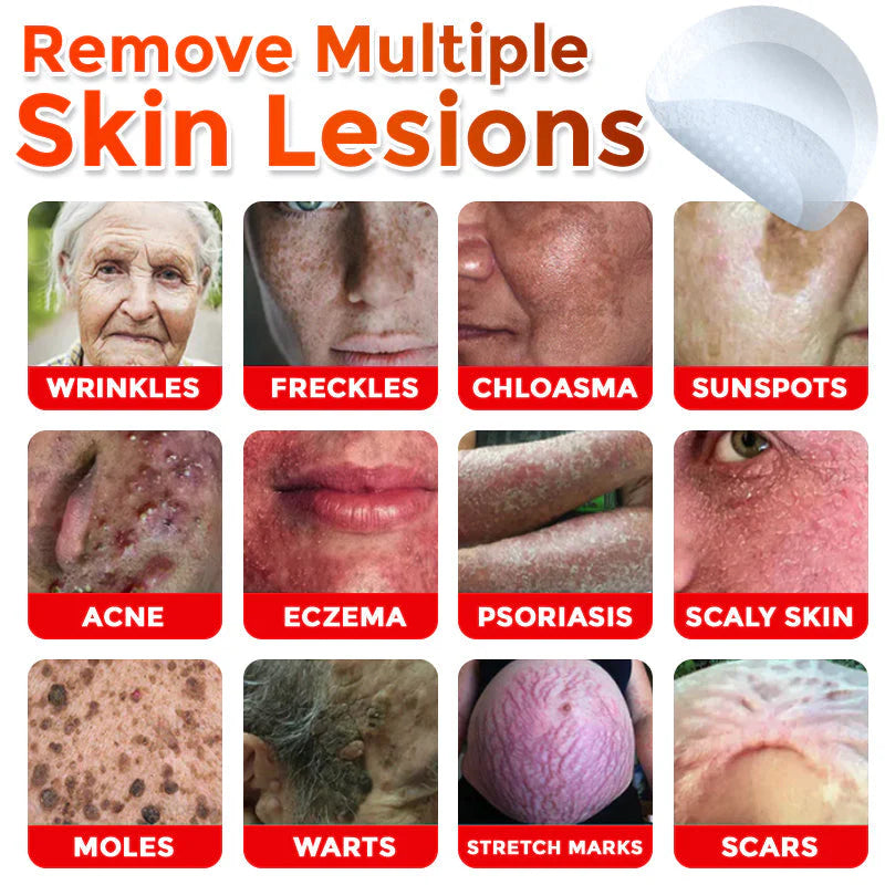 Slimoly™ MicroNeedle Botanic Skin Tag Removal Patch