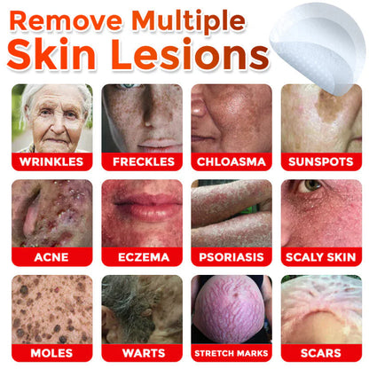 Slimoly™ MicroNeedle Botanic Skin Tag Removal Patch