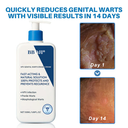 BBOJI®  HPV Genital Warts Eraser Cream Ultra