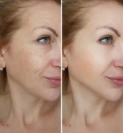 LOVILDS™🔥Power Redo Wrinkle Fix