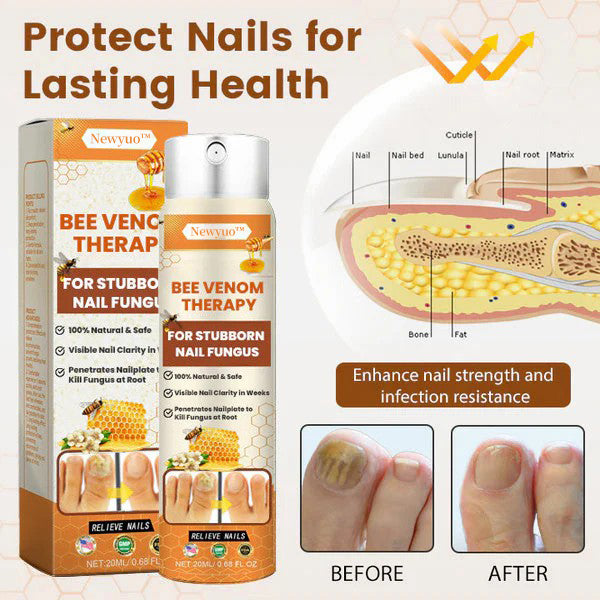 Newyuo™ NailRescue Bee Venom Nail Spray