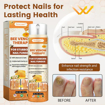 Newyuo™ NailRescue Bee Venom Nail Spray