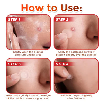 Slimoly™ MicroNeedle Botanic Skin Tag Removal Patch