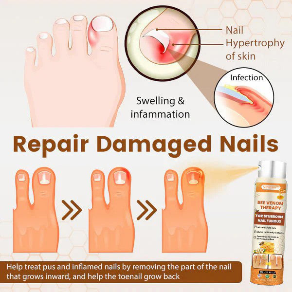 Newyuo™ NailRescue Bee Venom Nail Spray