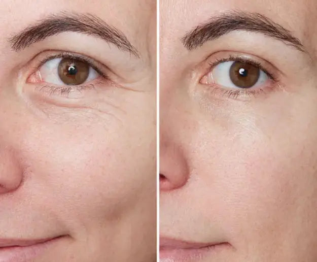 LOVILDS™🔥Power Redo Wrinkle Fix