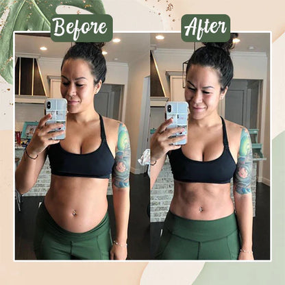 Juxek™Perfect Detox Slimming Patch（Limited Time Discount 🔥 Last Day）
