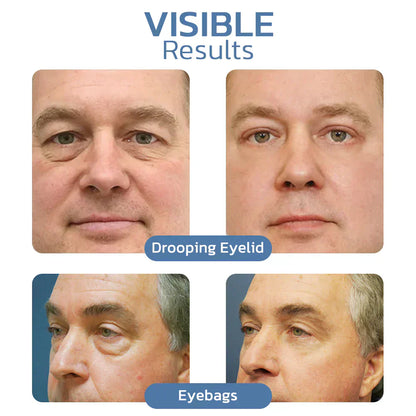 💙Final Day💙 LOVILDS™ Awaken Peptide Lifting Eye Gel