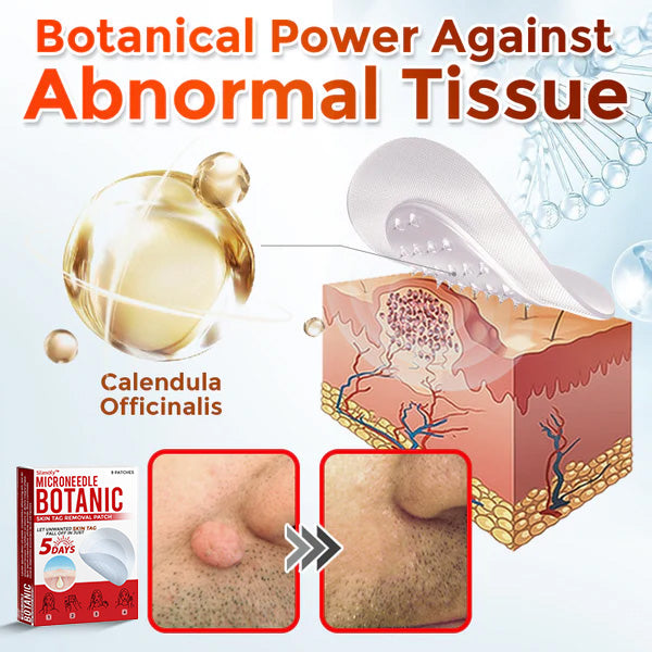 Slimoly™ MicroNeedle Botanic Skin Tag Removal Patch