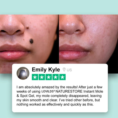 LOVILDS™NATURESTORE Instant Mole & Spot Gel