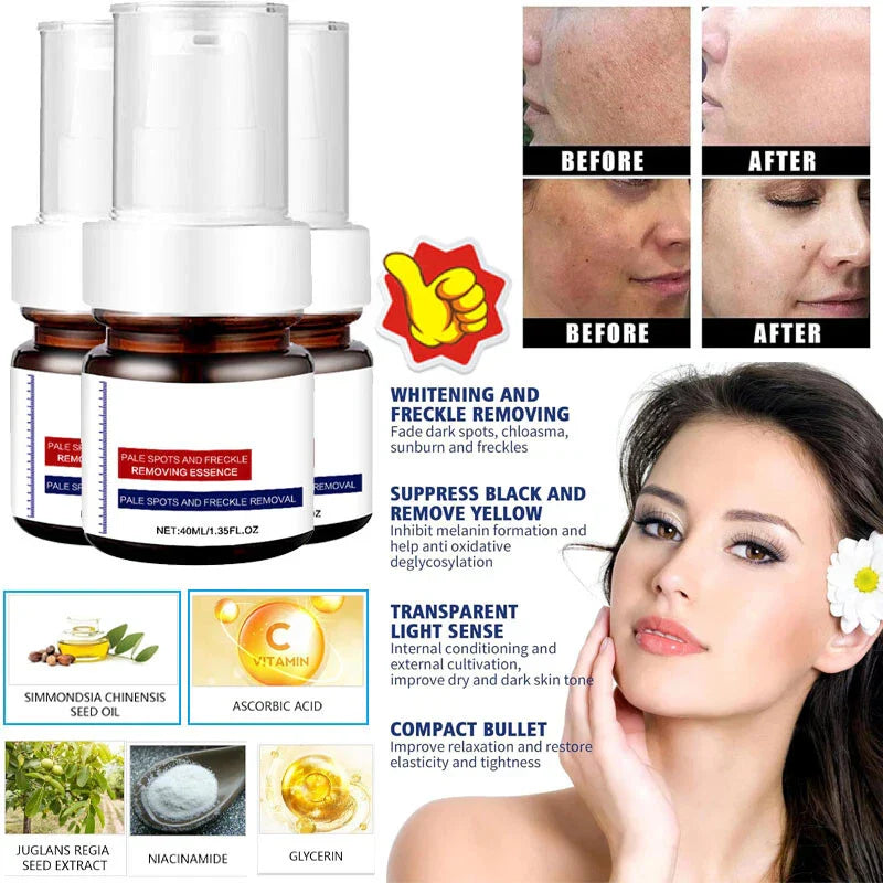 LOVILDS™  WHITENING ANDFRECKLE REMOVING ESSENCE