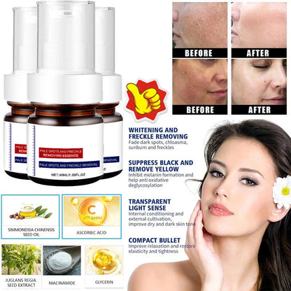 LOVILDS™  WHITENING ANDFRECKLE REMOVING ESSENCE