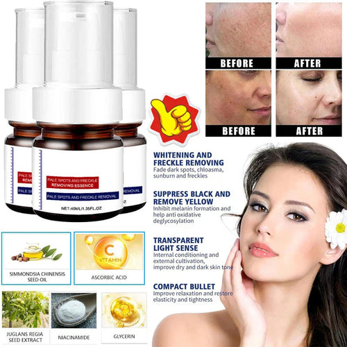 LOVILDS™  WHITENING ANDFRECKLE REMOVING ESSENCE